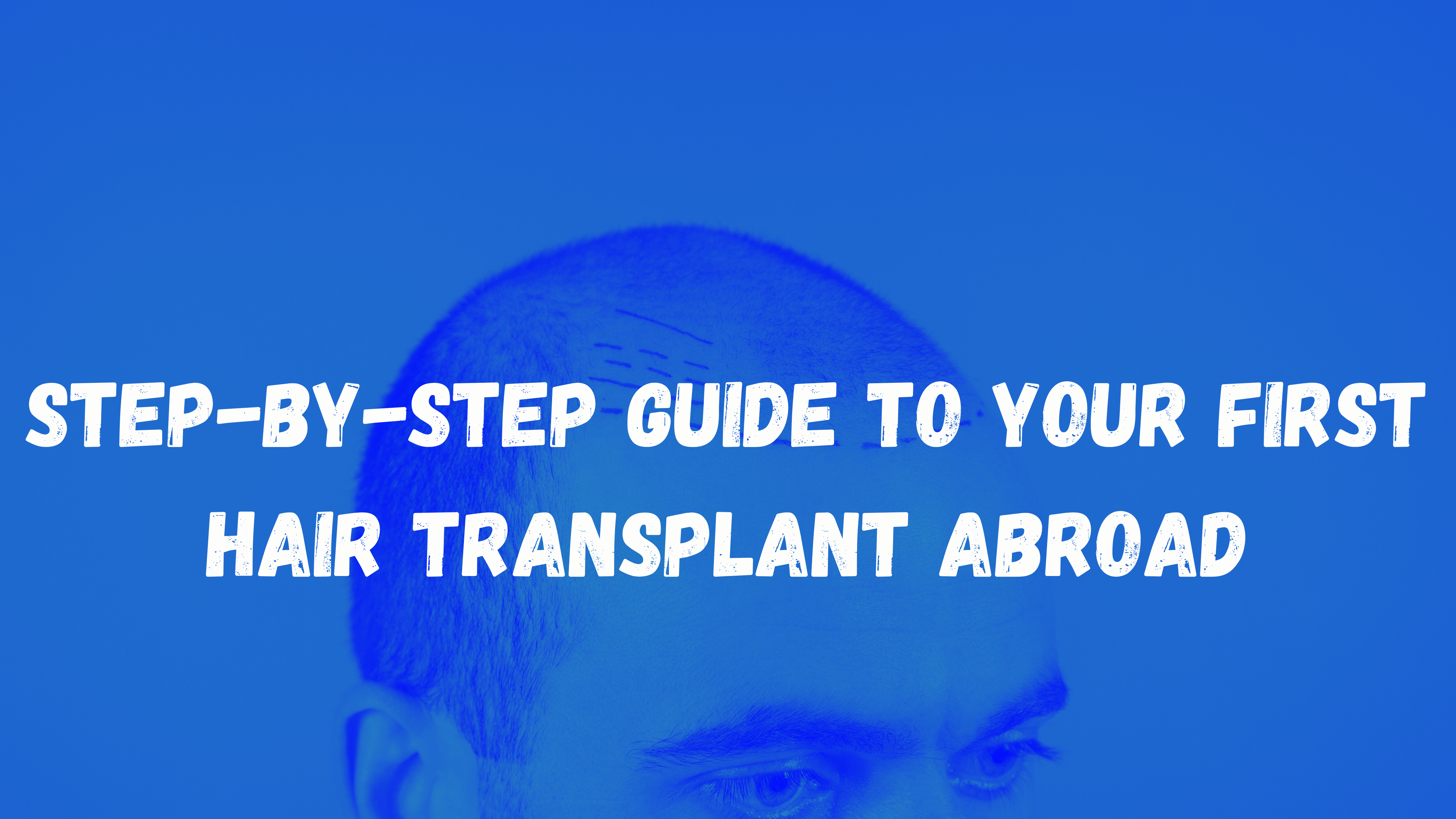 Read more about the article Step-by-Step Guide to Your First Hair Transplant Abroad